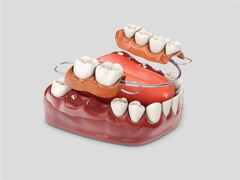 Smile with Confidence: The Benefits of Dentures